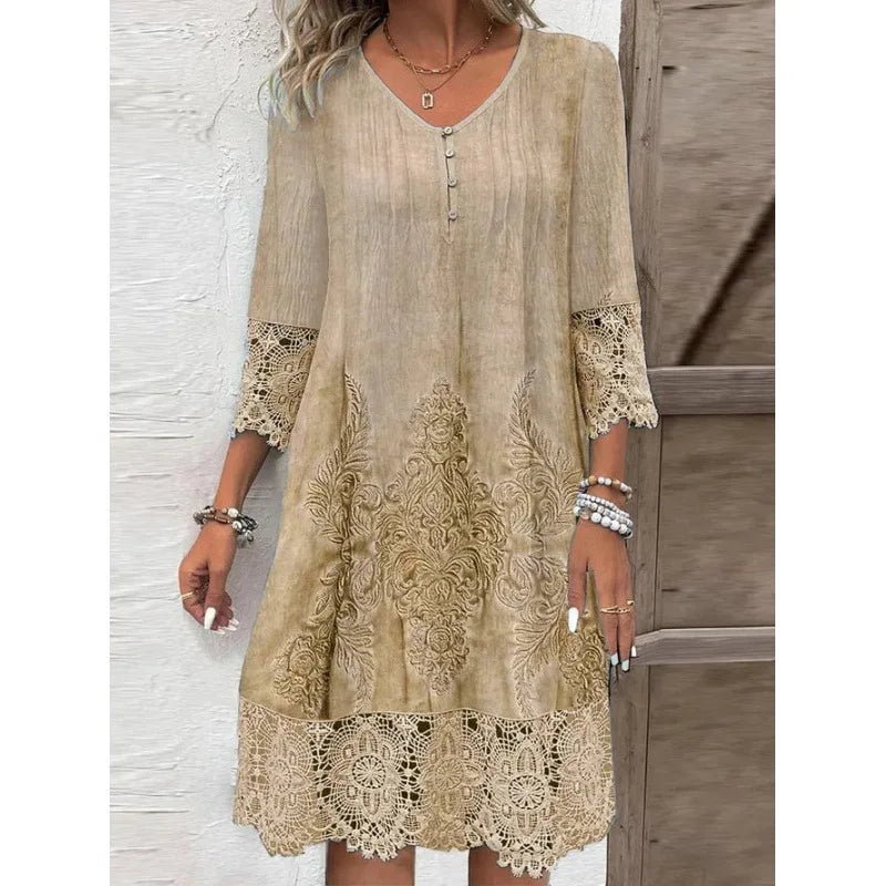 Women’s Spring Summer Lace Dress – Sexy Hollow Fashion Knee-Length Dress