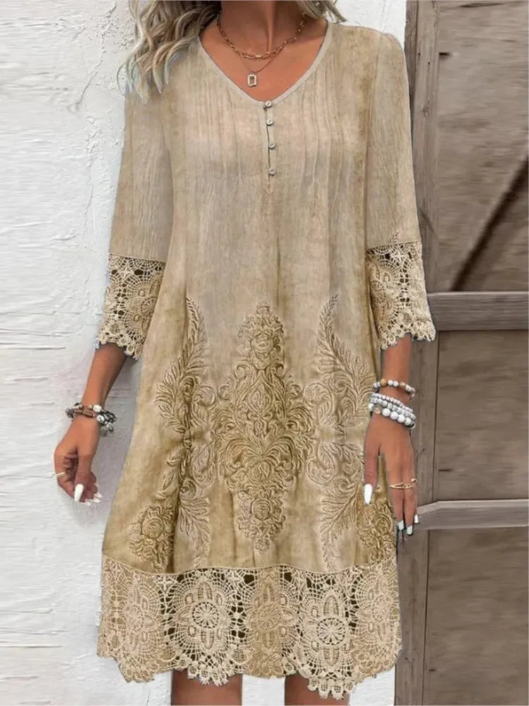 Women’s Spring Summer Lace Dress – Sexy Hollow Fashion Knee-Length Dress
