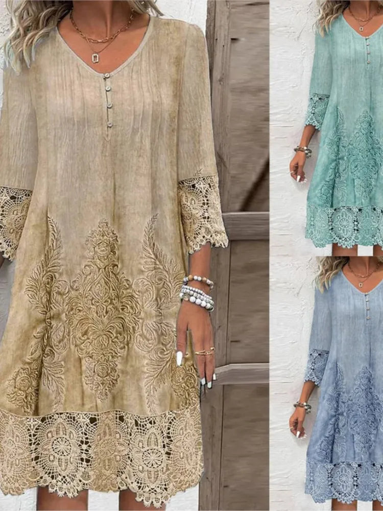Women’s Spring Summer Lace Dress – Sexy Hollow Fashion Knee-Length Dress
