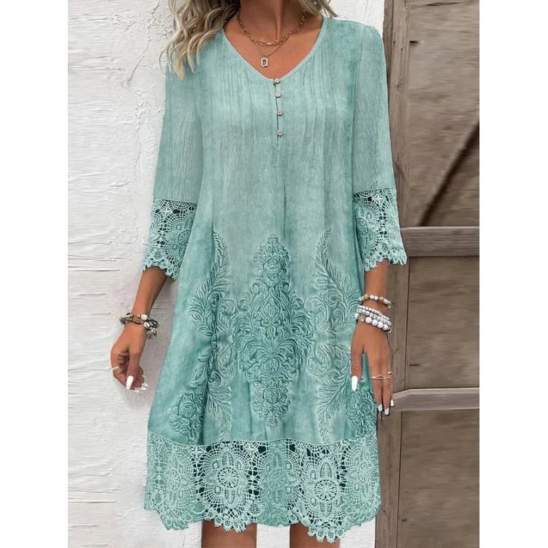 Women’s Spring Summer Lace Dress – Sexy Hollow Fashion Knee-Length Dress