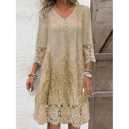 Women’s Spring Summer Lace Dress – Sexy Hollow Fashion Knee-Length Dress