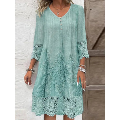 Women’s Spring Summer Lace Dress – Sexy Hollow Fashion Knee-Length Dress